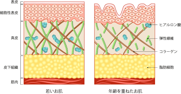 コラーゲンの違いとは