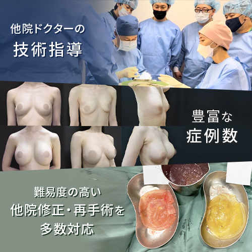 技術力の高い医師による豊胸手術