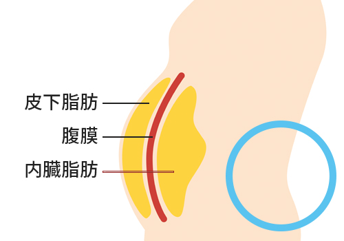 内臓脂肪は吸引できない