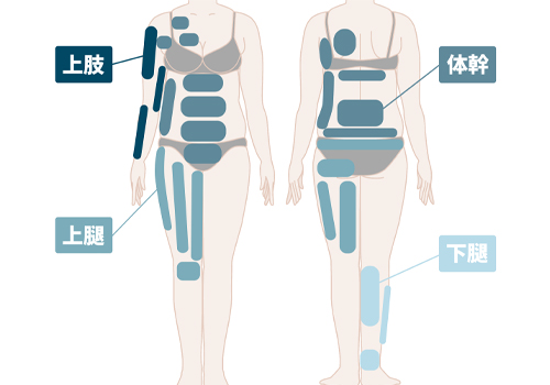 脂肪吸引が可能な身体の部位-体