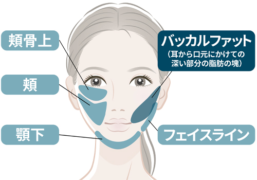 脂肪吸引が可能な身体の部位-顔