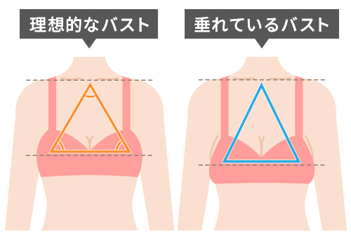そもそも垂れ乳とは？垂れ乳の定義と判断基準