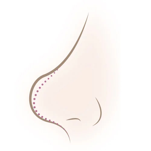 鼻先(鼻尖)が丸くて大きい