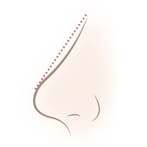 鼻の高さが足りず、平面的に見える