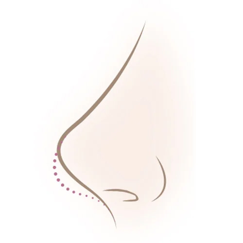 鼻柱の角度・長さのバランス