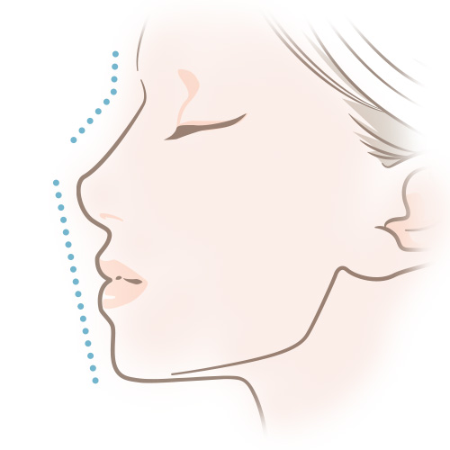 顔全体の骨格とのバランス