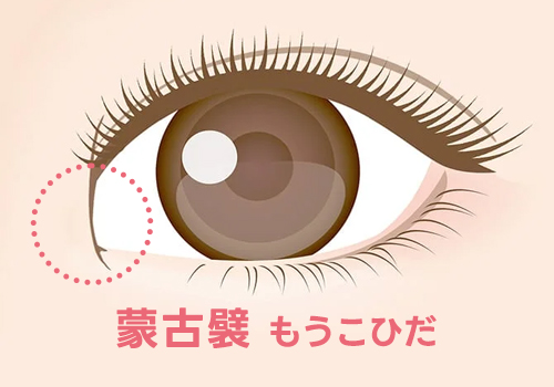 蒙古襞(もうこひだ)とは?