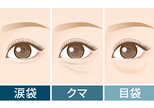 涙袋・クマ・目袋の違い
