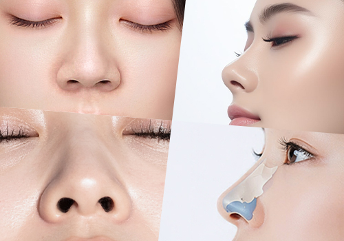 鼻の穴が大きく見える原因