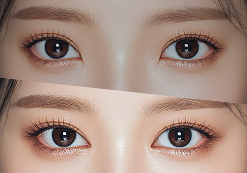 目と目の間が広く見える主な原因