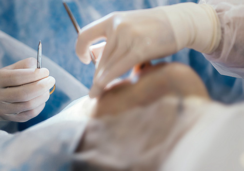 根本改善を目指すなら美容医療