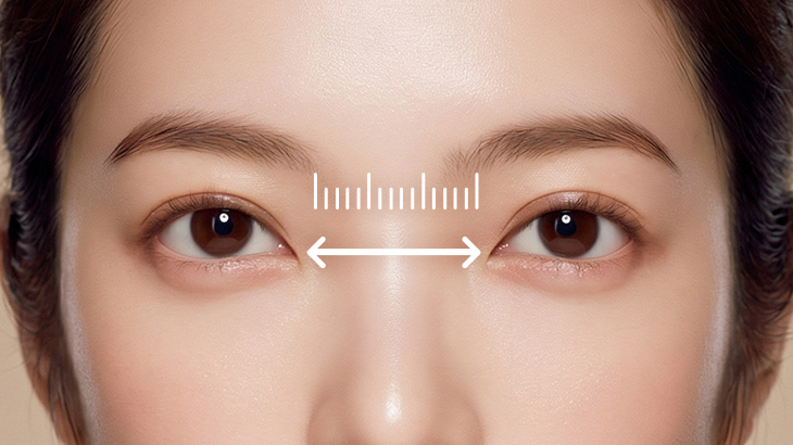 目と目の間が広い「離れ目」を改善するには？理想の黄金比も解説