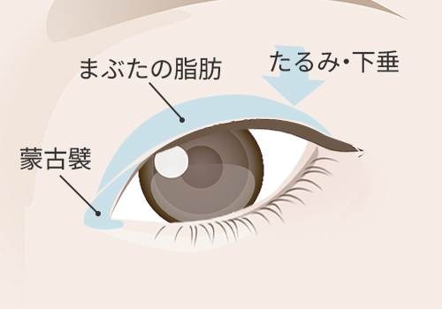 目が小さく見える主な原因