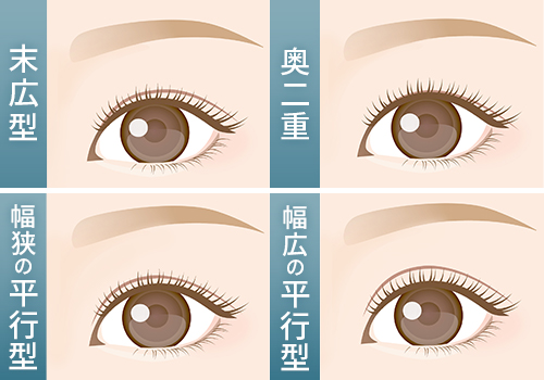 代表的な二重のデザインと特徴