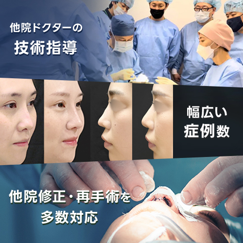 他院修正にも対応するジョウクリニックの鼻整形
