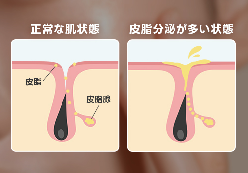 夕方のベタベタは「皮脂」が関係している