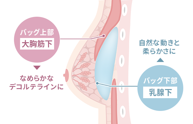 デュアルプレーン法