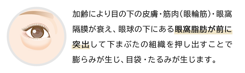 ジョウクリニックのクマ取り