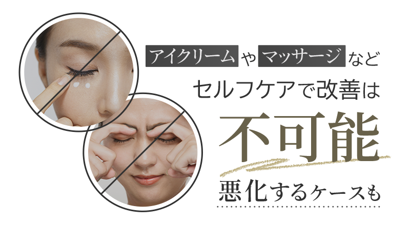 ジョウクリニックのクマ取り