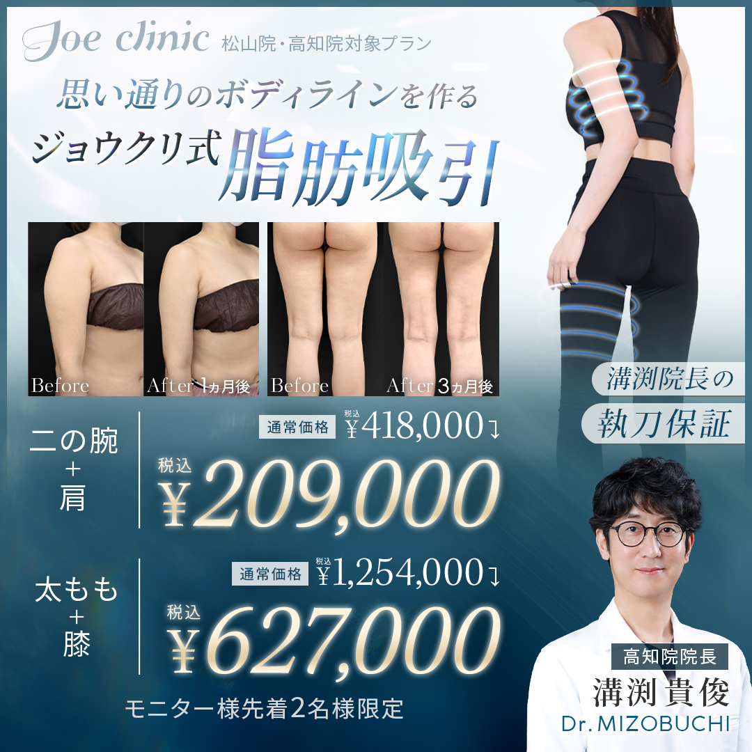 脂肪吸引キャンペーン