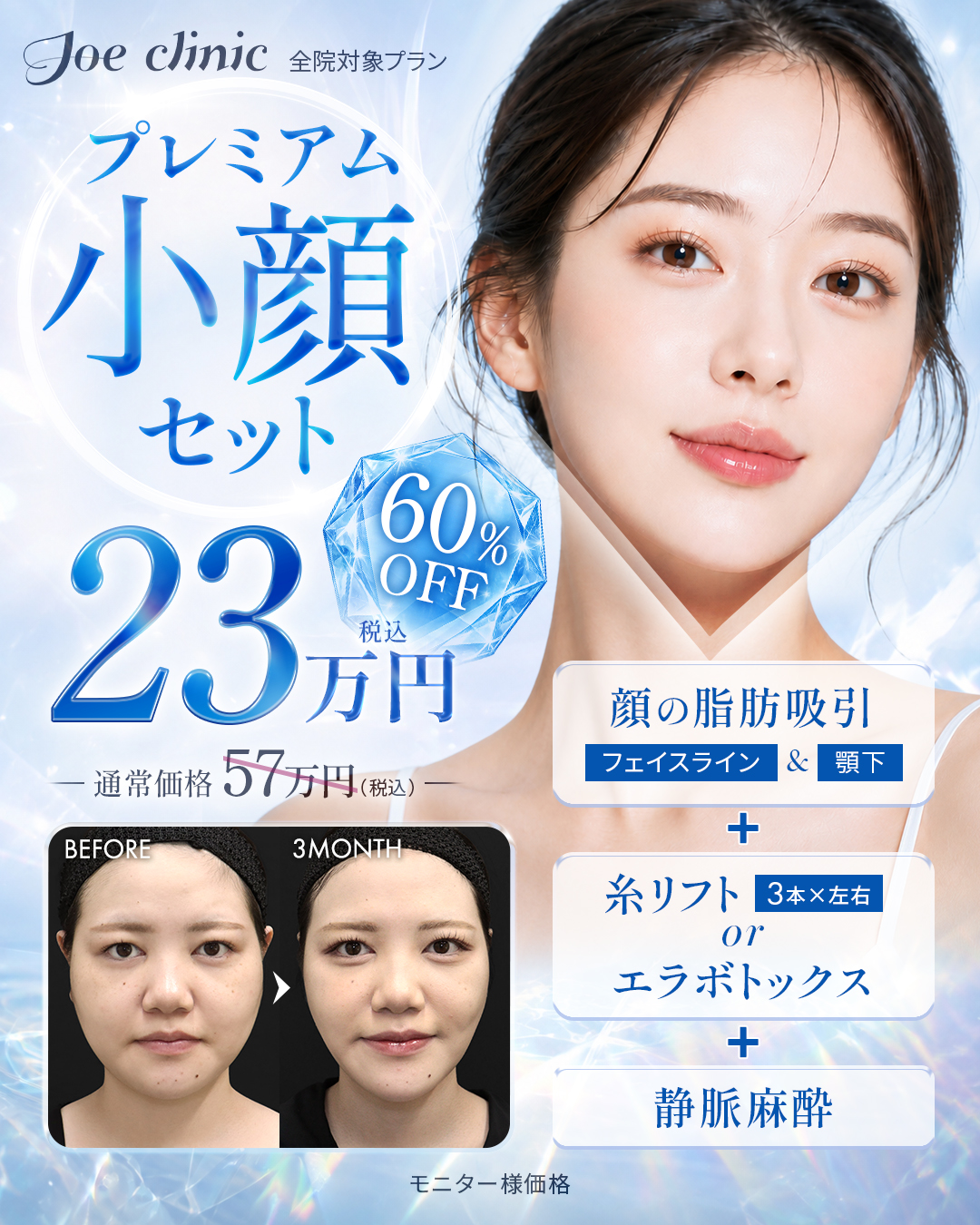 パーフェクト小顔キャンペーン