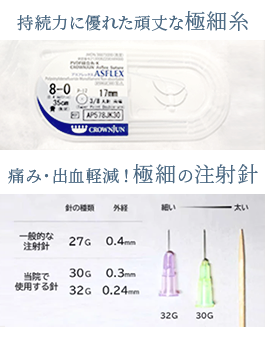 極細糸と極細の注射針で負担を軽減