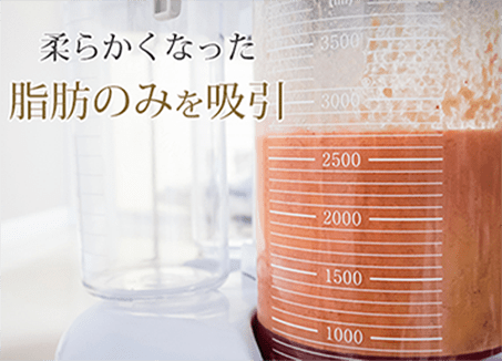 柔らかくなった脂肪のみ吸引