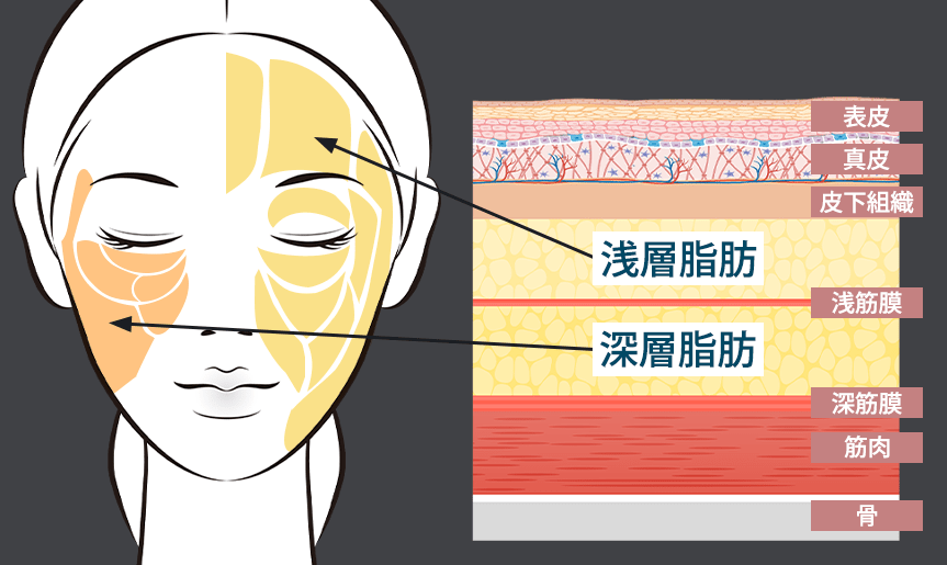 顔の脂肪の分布イラスト