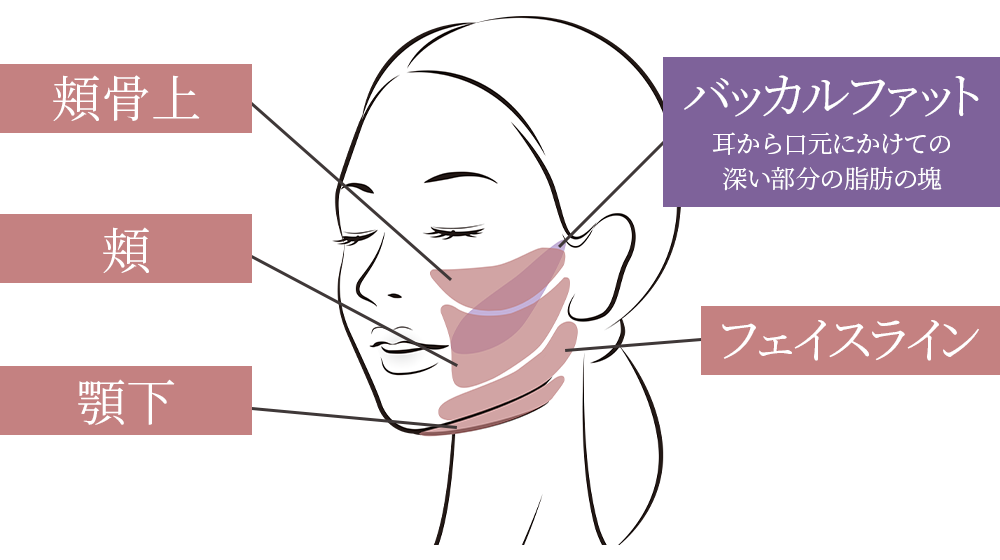 顔の吸引部位のイラスト
