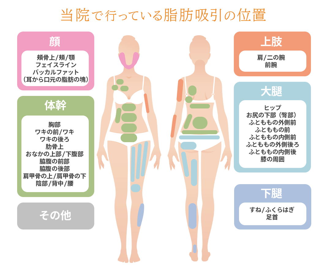 当院で行っている脂肪吸引の位置