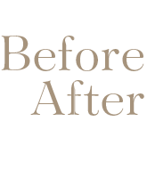 BeforeAfter