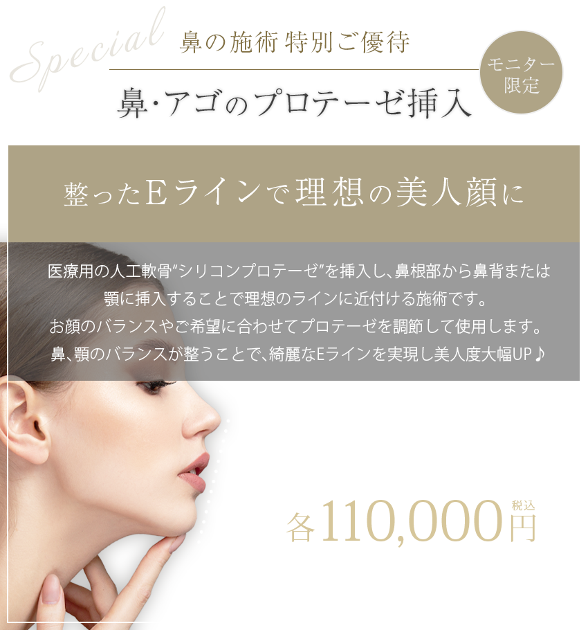 プロテーゼ挿入