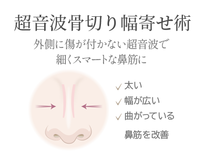 忘れ鼻セットオプション