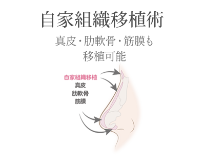 忘れ鼻セットオプション