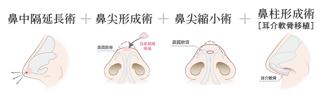 鼻フルコース
