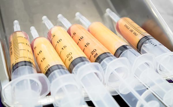 オーダーメイド治療