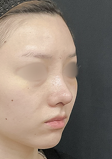症例写真