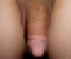 case01 施術後の症例写真（モザイク処理済み）