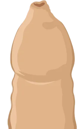 真性包茎の状態を示すイラスト
