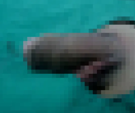 case 03（包茎術3か月後）施術前の症例写真（モザイク処理済み）