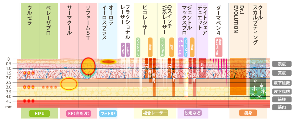 レーザー機器の比較