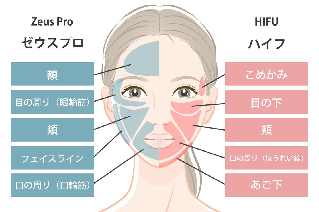 Zeus Proと医療用 HIFU(ハイフ)で効果の出る場所
