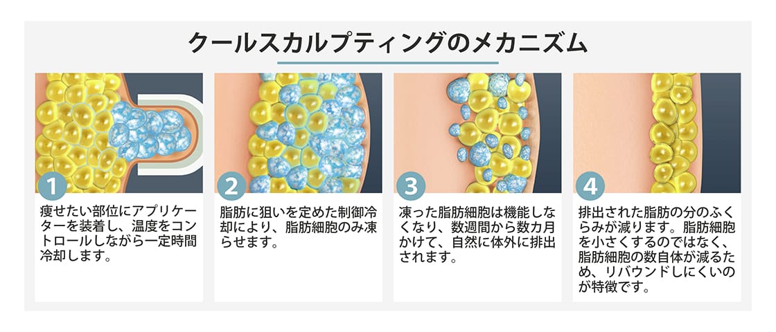 クールスカルプティングのメカニズム