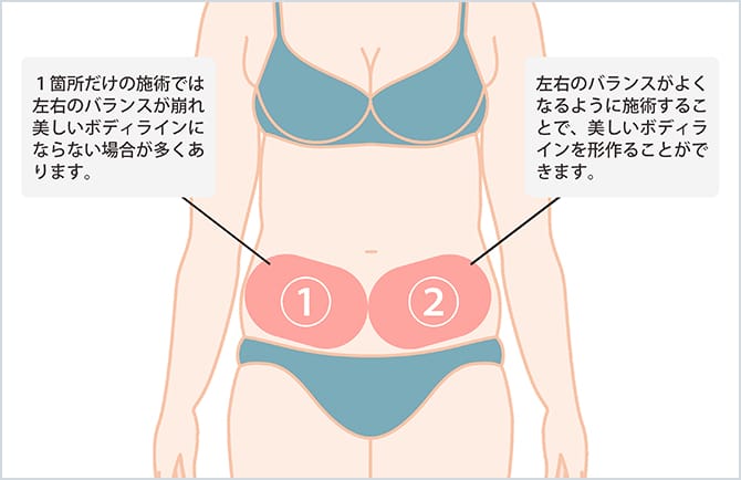 【クール・スムース プロ】アプリケーターの治療範囲例