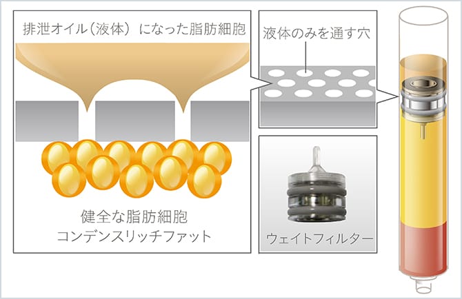 不純な排泄オイルと新鮮で健全な脂肪との分離