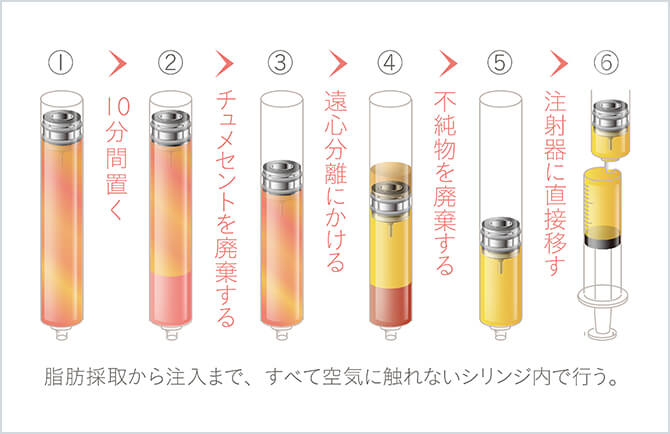分離までのプロセス