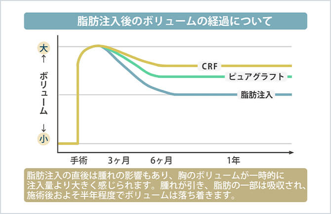 脂肪注入豊胸の時間経過とバスとサイズの関係グラフ