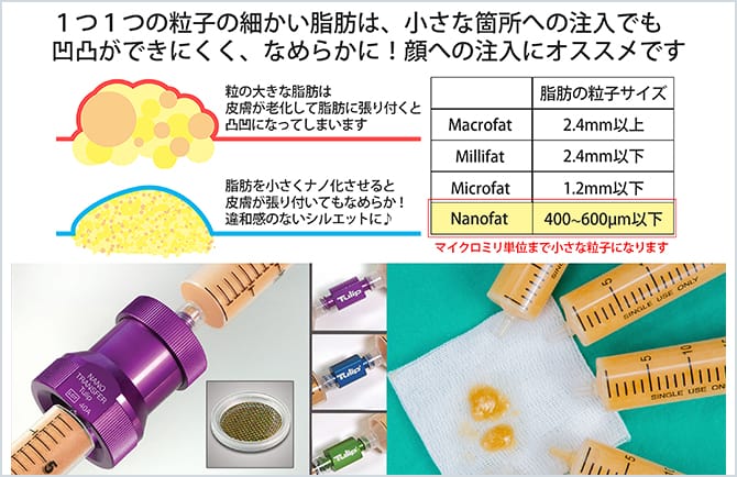 脂肪の塊による凹凸の心配なし