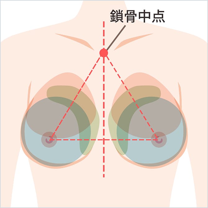 豊胸部分のデザイン