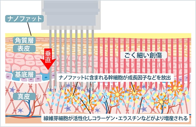ゴールデンスキンフェイシャルの治療